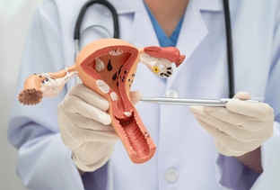 Cervical Cancer Treatment